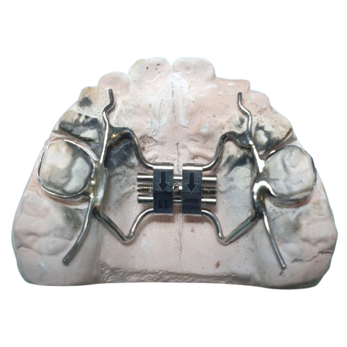 disyunción ortodoncia